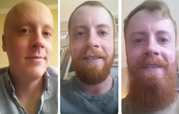 three photos of a man not shaving for a whole month